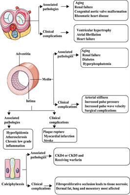 Insights Into the Role of Mitochondria in Vascular Calcification